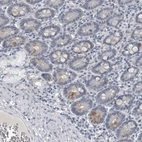 Immunohistochemical staining of human duodenum shows weak cytoplasmic positivity in glandular cells.