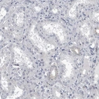 Immunohistochemical staining of human kidney shows no cytoplasmic positivity in cells in tubules as expected.