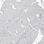 Immunohistochemical staining of human skeletal muscle shows no cytoplasmic positivity in myocytes as expected.