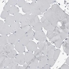 Immunohistochemical staining of human skeletal muscle shows no cytoplasmic positivity in myocytes as expected.