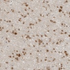 Anti-CC2D1B Antibody
