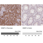 Anti-GNMT Antibody