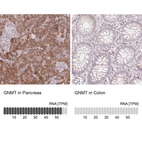 Anti-GNMT Antibody