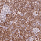 Anti-GNMT Antibody