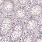 Immunohistochemical staining of human colon shows low expression as expected.