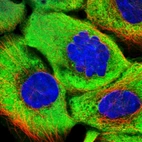 Immunofluorescent staining of human cell line A-431 shows localization to cytosol.