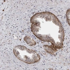 Anti-GCSAML Antibody