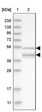 Lane 1: Marker [kDa] 230, 130, 95, 72, 56, 36, 28, 17, 11_br/_Lane 2: Human cell line RT-4