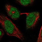 Immunofluorescent staining of human cell line U-2 OS shows localization to nucleoplasm.