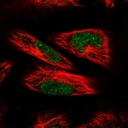 Immunofluorescent staining of human cell line U-251 MG shows localization to nucleoplasm.