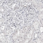 Anti-VEZF1 Antibody