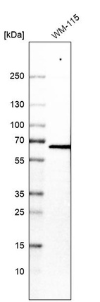 Western blot analysis in human cell line WM-115.
