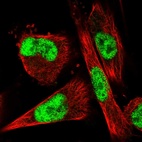 Immunofluorescent staining of human cell line U-251 MG shows localization to nucleoplasm.