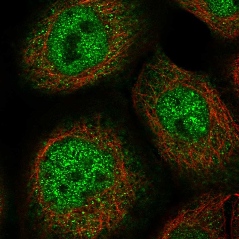 Anti-ZSCAN26 Antibody