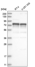 Western blot analysis in human cell line RT-4 and human cell line U-251 MG.