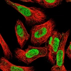 Immunofluorescent staining of human cell line U-2 OS shows localization to nucleoplasm & vesicles.