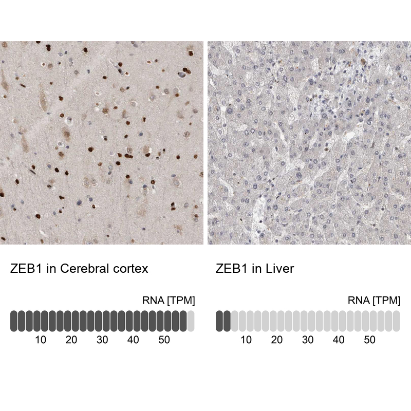 Anti-ZEB1 Antibody