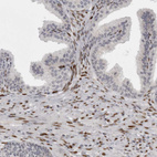 Immunohistochemical staining of human prostate shows strong nuclear positivity in smooth muscle cells.