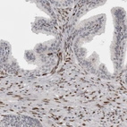 Immunohistochemical staining of human prostate shows strong nuclear positivity in smooth muscle cells.