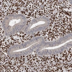 Immunohistochemical staining of human endometrium shows strong nuclear positivity in stromal cells.