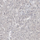 Immunohistochemical staining of human liver shows no nuclear positivity in hepatocytes as expected.