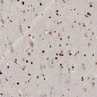 Immunohistochemical staining of human cerebral cortex shows strong nuclear positivity in glial cells.