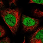 Immunofluorescent staining of human cell line U-2 OS shows localization to nucleoplasm.