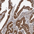 Immunohistochemical staining of human duodenum shows strong granular cytoplasmic positivity in glandular cells.