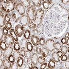 Immunohistochemical staining of human kidney shows strong granular cytoplasmic positivity in cells in tubules.
