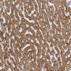 Immunohistochemical staining of human liver shows strong granular cytoplasmic positivity in hepatocytes.