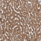 Immunohistochemical staining of human liver shows strong granular cytoplasmic positivity in hepatocytes.