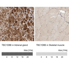 Anti-TBC1D8B Antibody