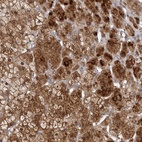 Anti-TBC1D8B Antibody