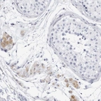 Immunohistochemical staining of human testis shows moderate cytoplasmic positivity in Leydig cells.