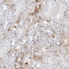 Immunohistochemical staining of human kidney shows moderate positivity in plasma.