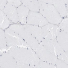 Immunohistochemical staining of human skeletal muscle shows no positivity in myocytes as expected.