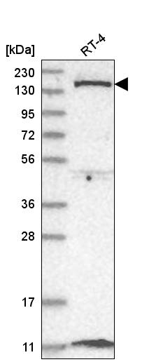 Anti-DGKD Antibody