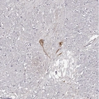 Anti-GNRH1 Antibody