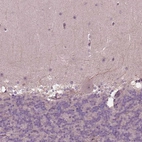 Immunohistochemical staining of human cerebellum shows very weak positivity in neuronal processes.
