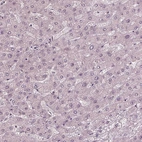 Immunohistochemical staining of human liver shows no positivity in hepatocytes as expected.