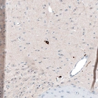 Immunohistochemical staining of rat brain shows strong cytoplasmic positivity in neurons in anterior hypothalamus.