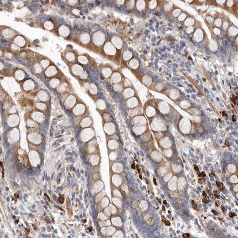 Anti-ATXN3L Antibody