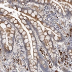 Anti-ATXN3L Antibody