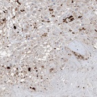 Anti-SPP1 Antibody