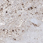 Immunohistochemical staining of human placenta shows high expression.