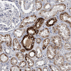 Immunohistochemical staining of human kidney shows strong positivity in cytoplasm and secretion in tubules.