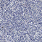 Anti-SPP1 Antibody