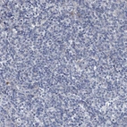 Immunohistochemical staining of human tonsil shows low positivity in non-germinal center cells as expected.
