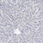 Anti-SPP1 Antibody