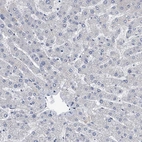 Immunohistochemical staining of human liver shows low positivity in hepatocytes as expected.